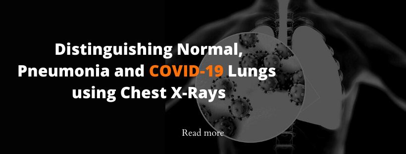 Distinguishing Normal Pneumonia and COVID 19 Chest X Ray